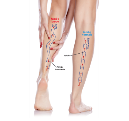 Masseur intelligent  WellBeing™